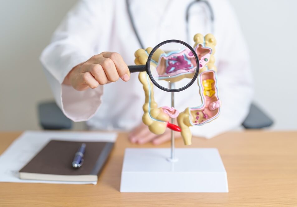Doctor,With,Human,Colon,Anatomy,Model,And,Magnifying,Glass.,Colonic